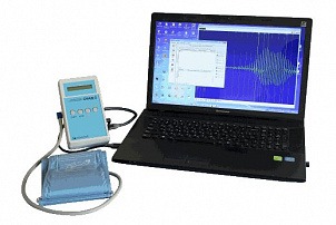 Аппарат для регистрации колебаний пульсовой волны СКАД-2